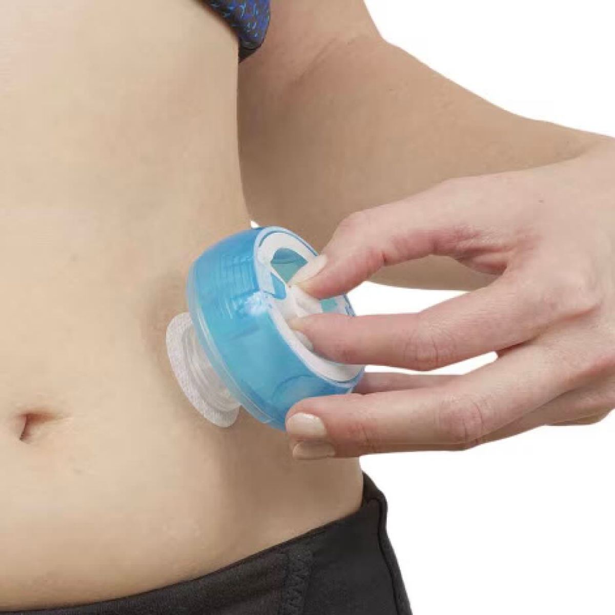 I-Port Advance 6 mm Subkutan Injeksjonsport 10 stk