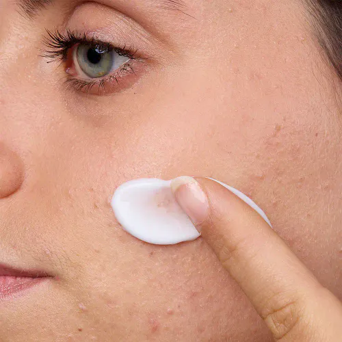 Isispharma Teen Derm A.Z 30 ml