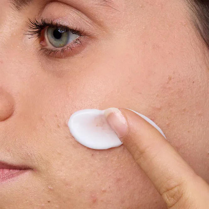 Hovedbilde Isispharma Teen Derm A.Z 30 ml